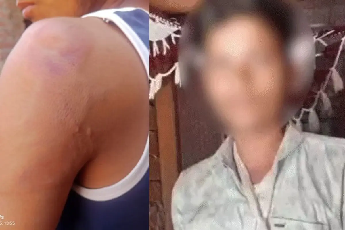 dalit student beaten
