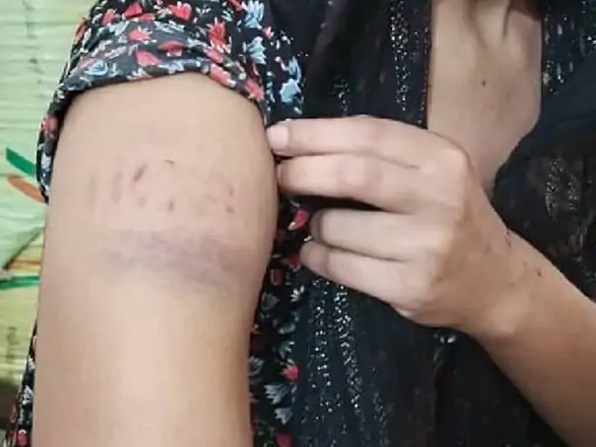 dalit attacked
