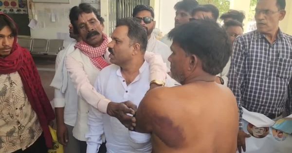 beats up Dalit youth